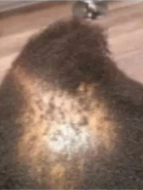 Before — Hair regrowth results